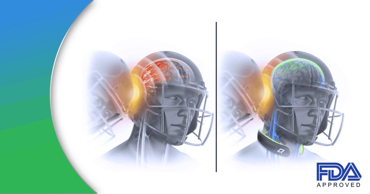 Innovative Technology Taken To The Sports Industry – Q30 Innovations Case Study